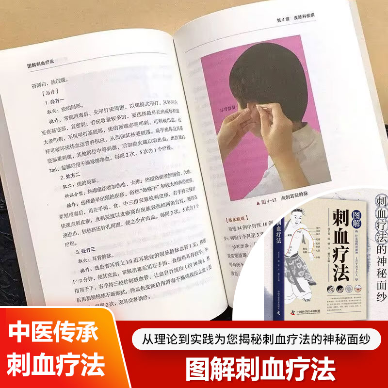 A terapia de sangria explicada - Therapy Health And Wellness avaliação e preço